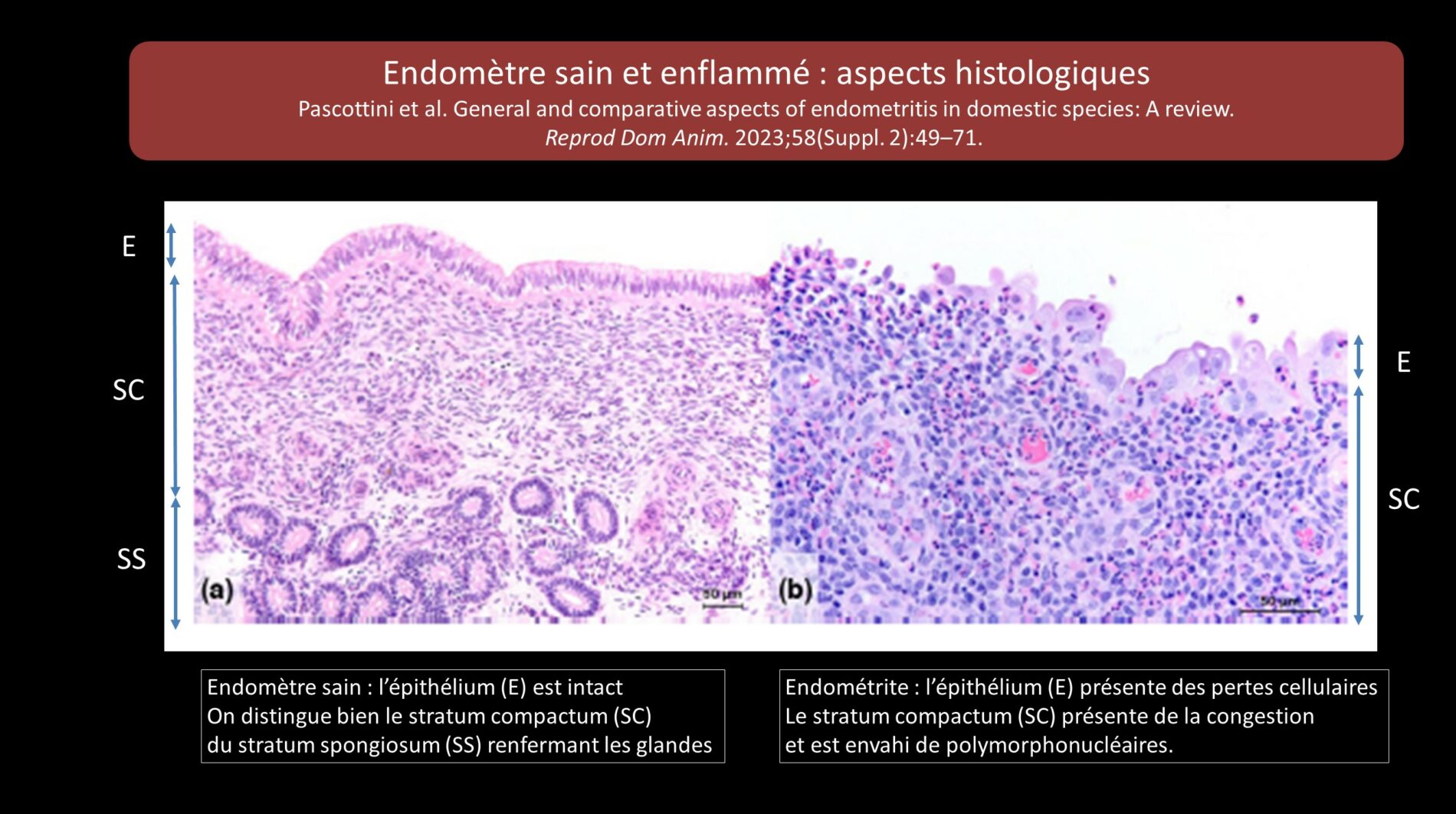 Pascottini 2023 Cytologie EC vs ESC infections uterines